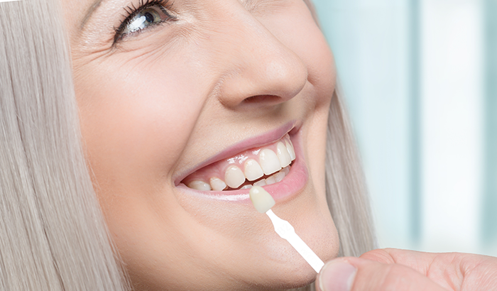 Woman smiling.
